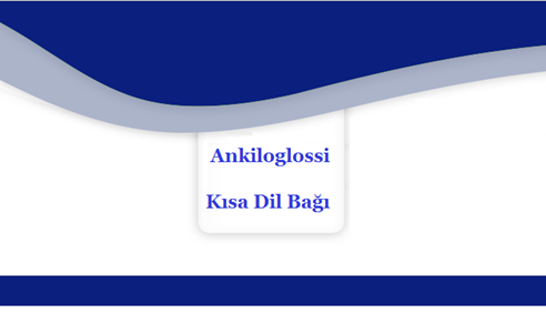 Ankiloglossi