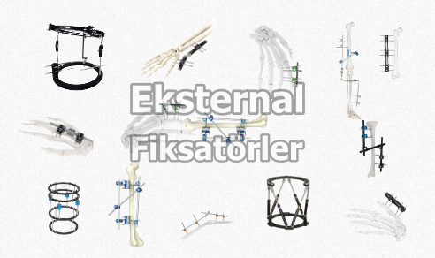 Eksternal Fiksatörler