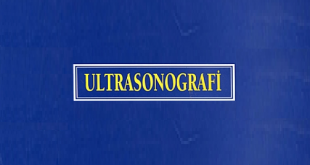 Ultrasonografi