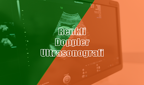Renkli Doppler Ultrasonografi